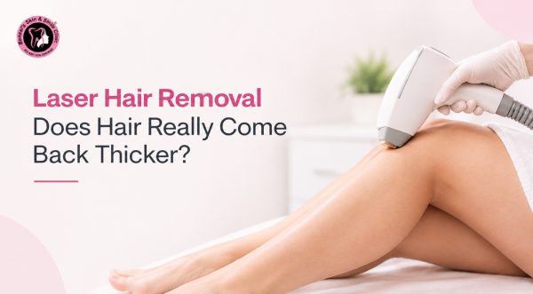 laser hair removal in shalimar bagh